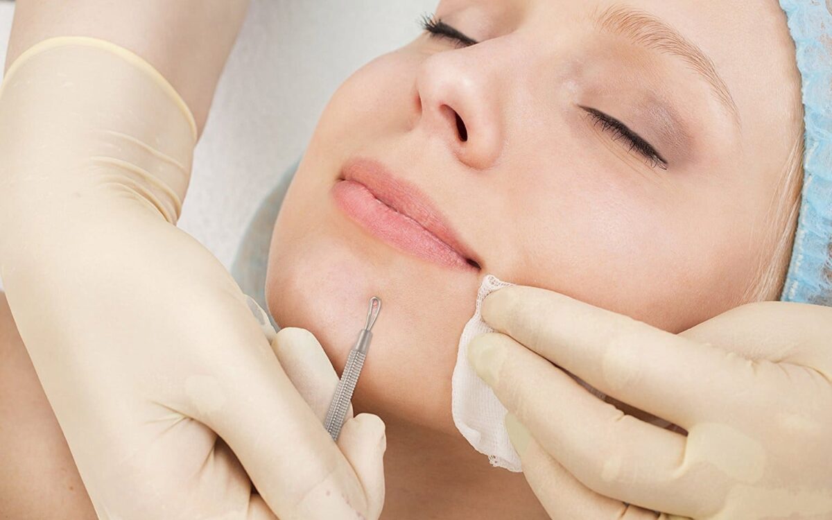 Dr. Papikian Skin Health Clinic - manuele gezichtsreiniging